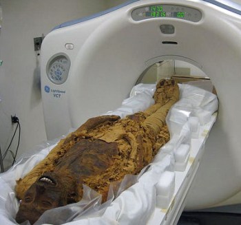 MummiesAtherosclerosis3